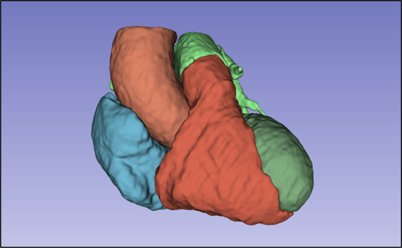 heart 3D